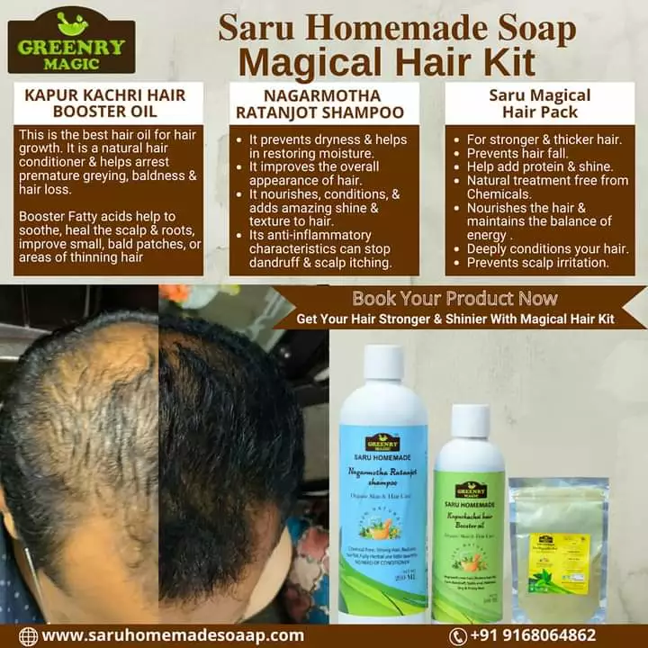 99.99% solution आप के गंजेपन और झड़ते हुए बालों के लिए
बिना किसी अतिरिक्त दर्द भरे महंगे ट्रीटमेंट ओ uploaded by Saru Homemade Soap  on 7/28/2022