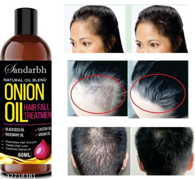 Product image with price: Rs. 300, ID: onion-oil-656928ae